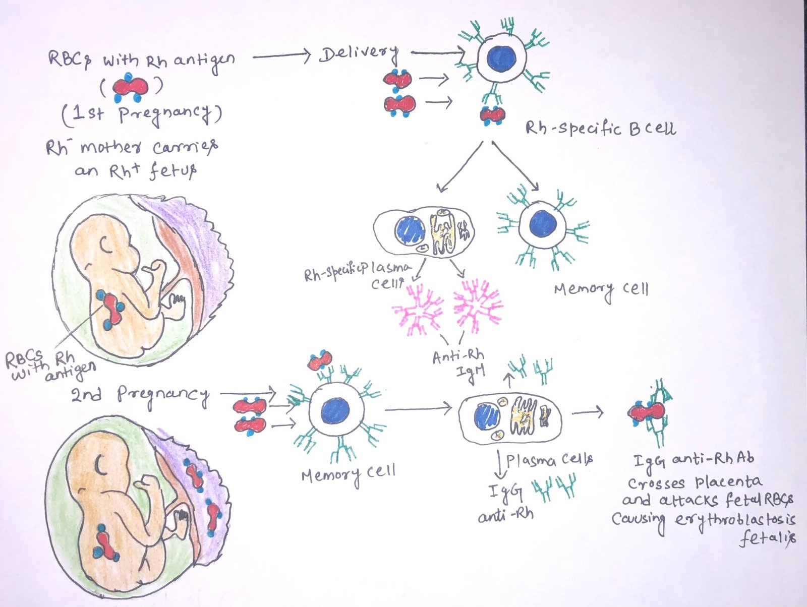 Development of Erythroblastosis Fetalis