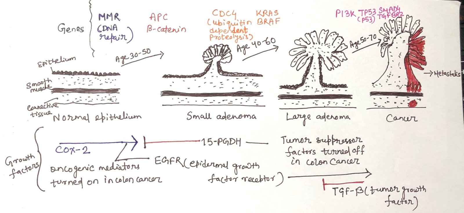 development of colorectal cancer